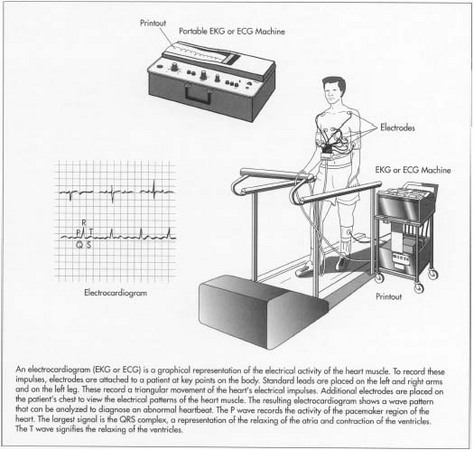 electrocardiogram machine